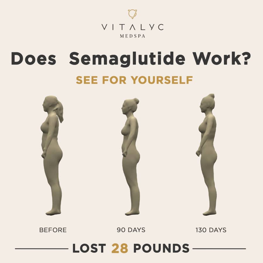 weight loss injections-Results-Vitalyc-Medspa